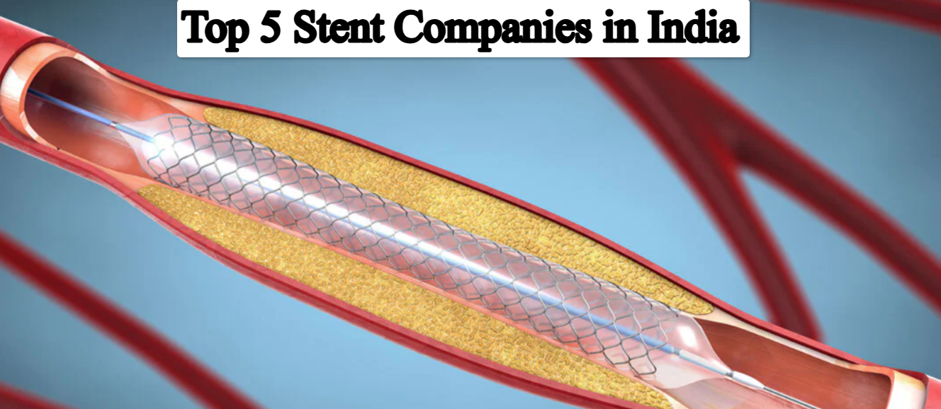 Top 5 Best Stent Companies in India